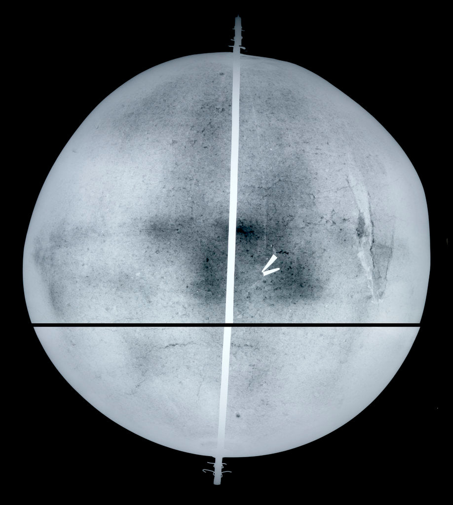 Detail of Globe x-ray by Gemma Frisius