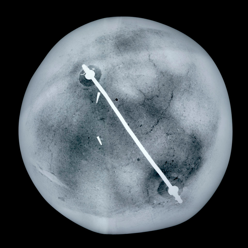 Detail of Globe x-ray by Gemma Frisius