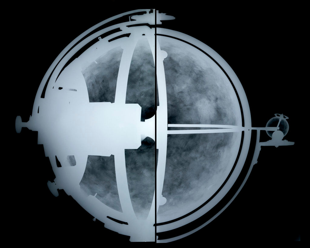 Detail of Globe x-ray by John Russell