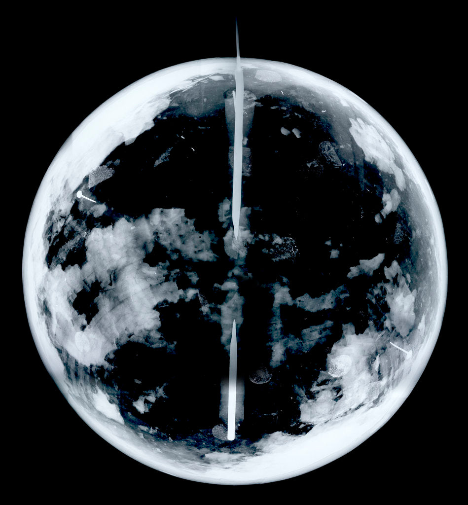Detail of Globe x-ray by unknown