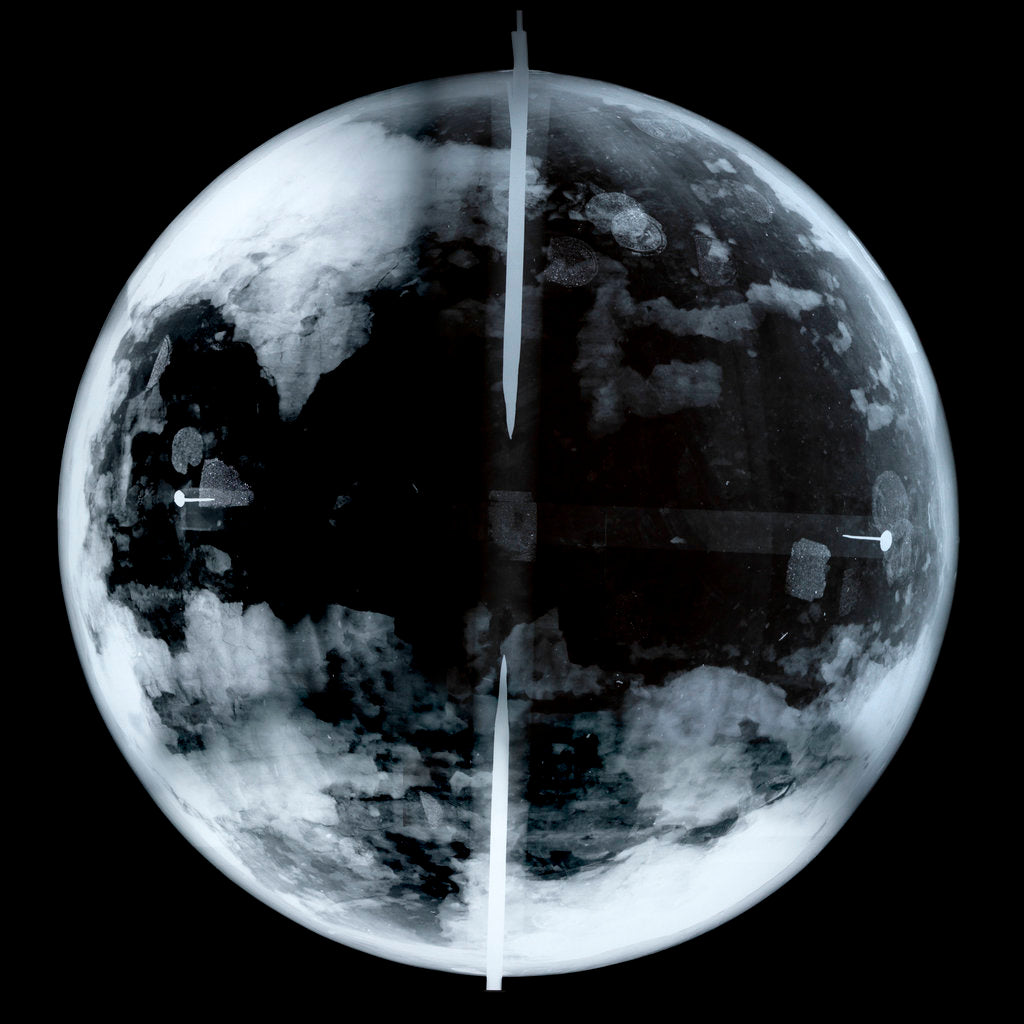 Detail of Globe x-ray by unknown