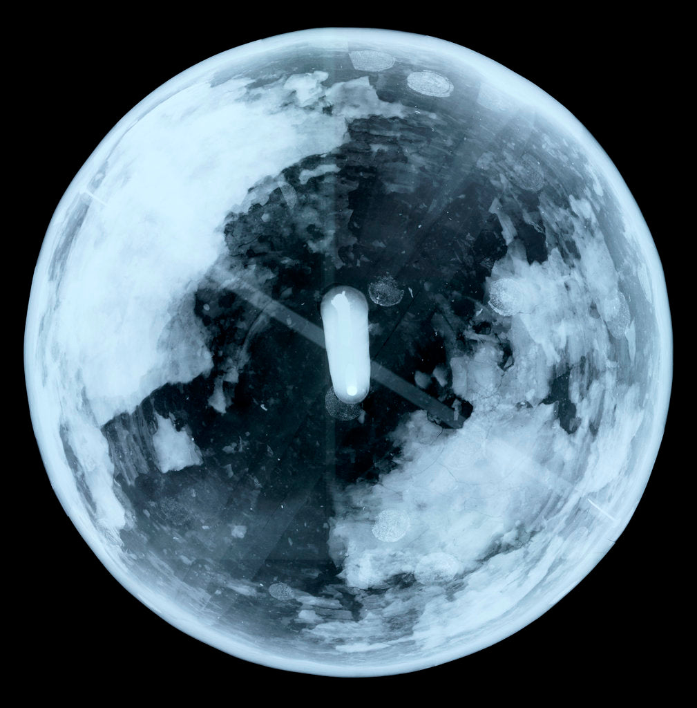 Detail of Globe x-ray by unknown