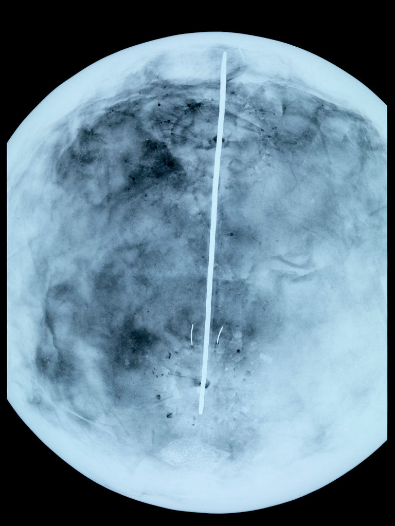 Detail of Globe x-ray by Giovanni Maria Cassini