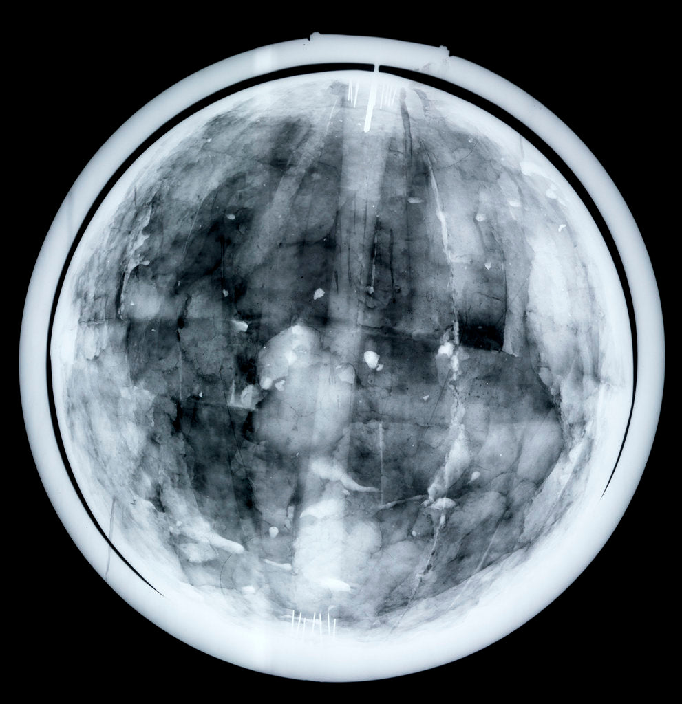 Detail of Globe x-ray by Jacques Hardy
