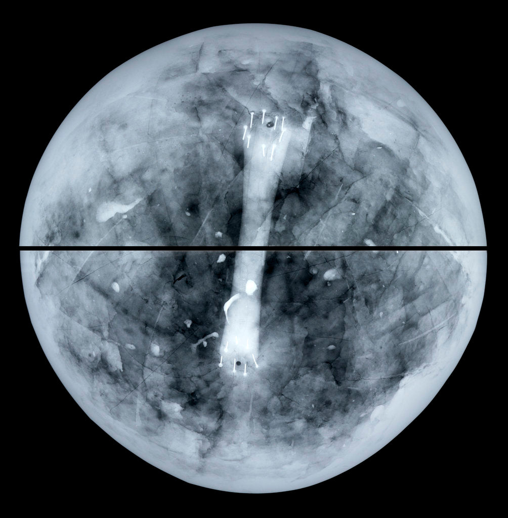 Detail of Globe x-ray by Jacques Hardy
