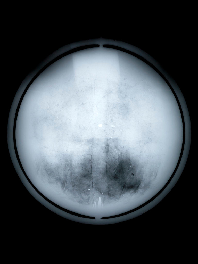 Detail of Globe x-ray by Charles Price