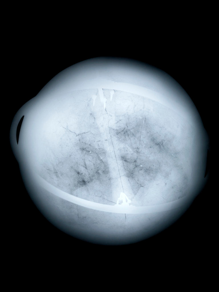 Detail of Globe x-ray by Charles Price