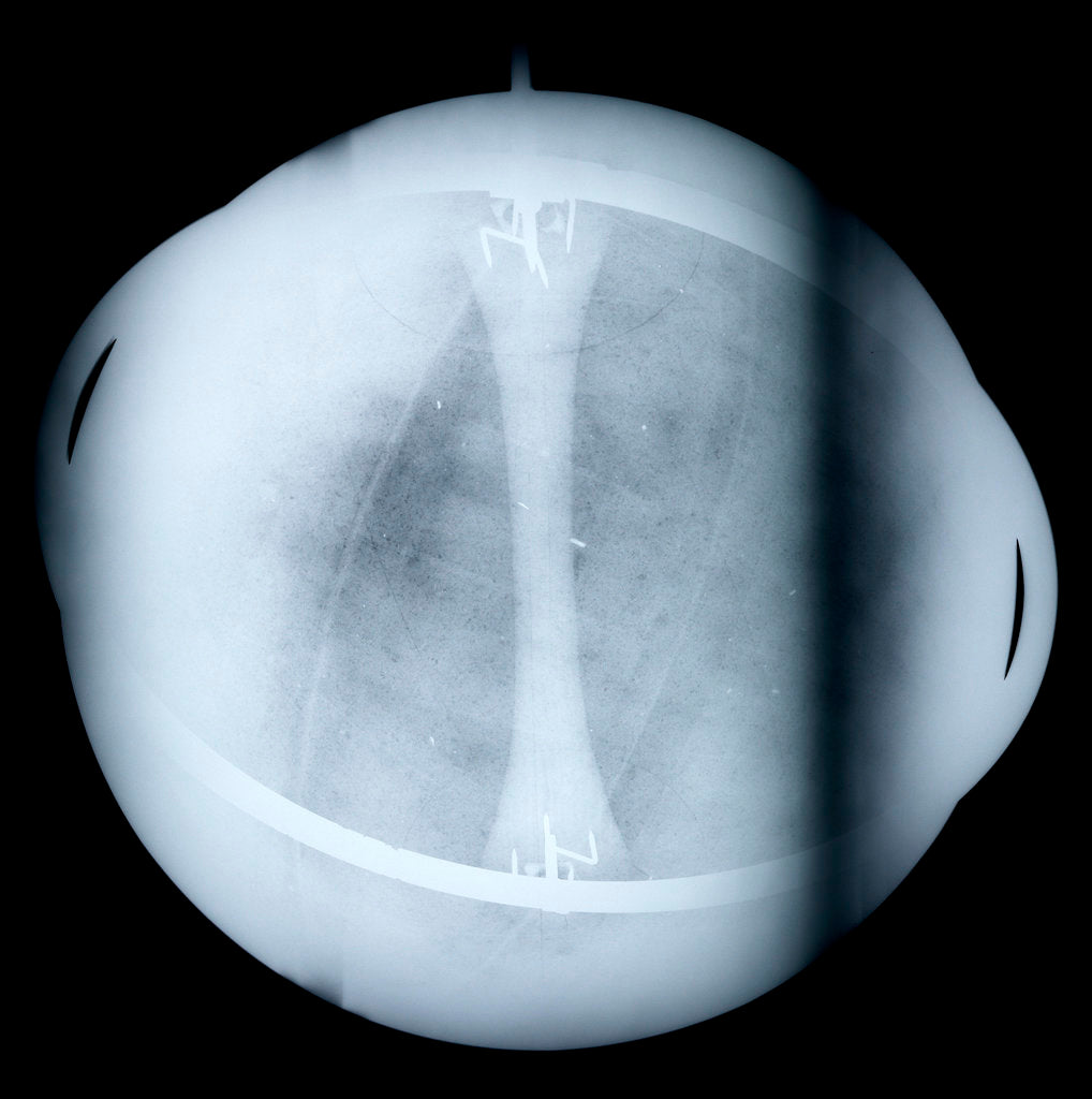Detail of Globe x-ray by Jacques de La Feuille