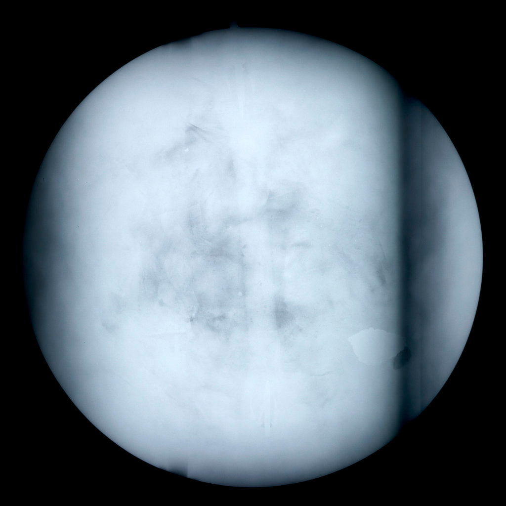 Detail of Globe x-ray by Robert Morden