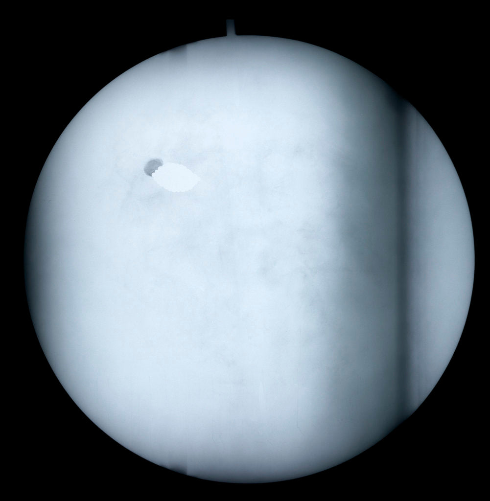 Detail of Globe x-ray by Robert Morden