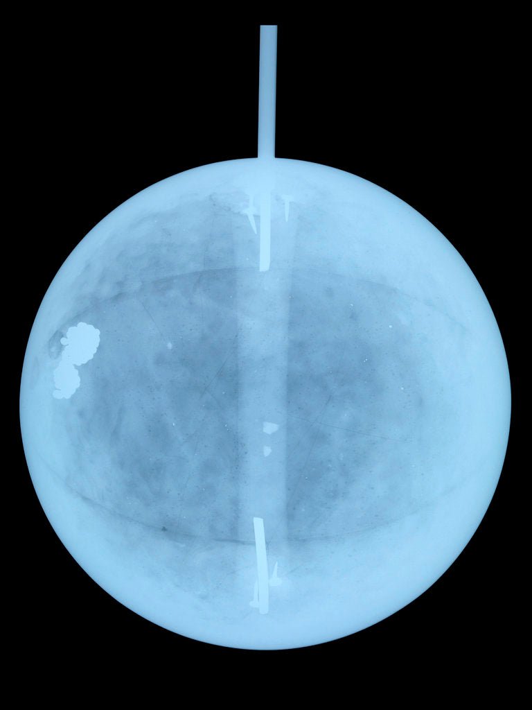 Detail of Globe x-ray by William Bardin
