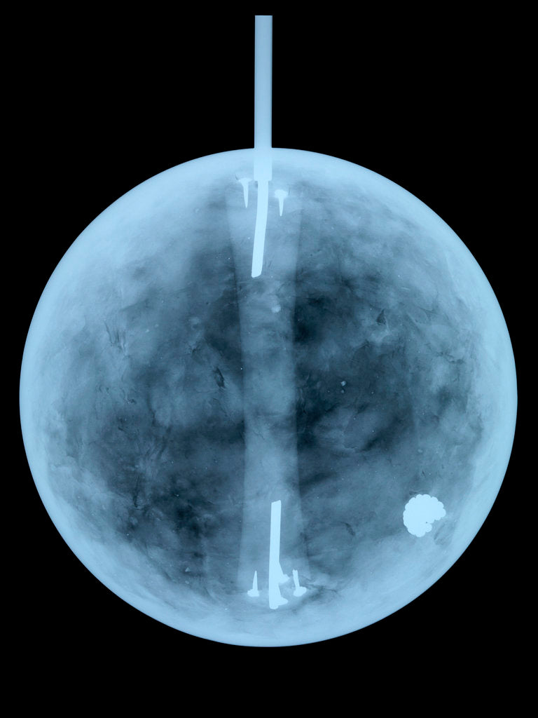 Detail of Globe x-ray by William Bardin