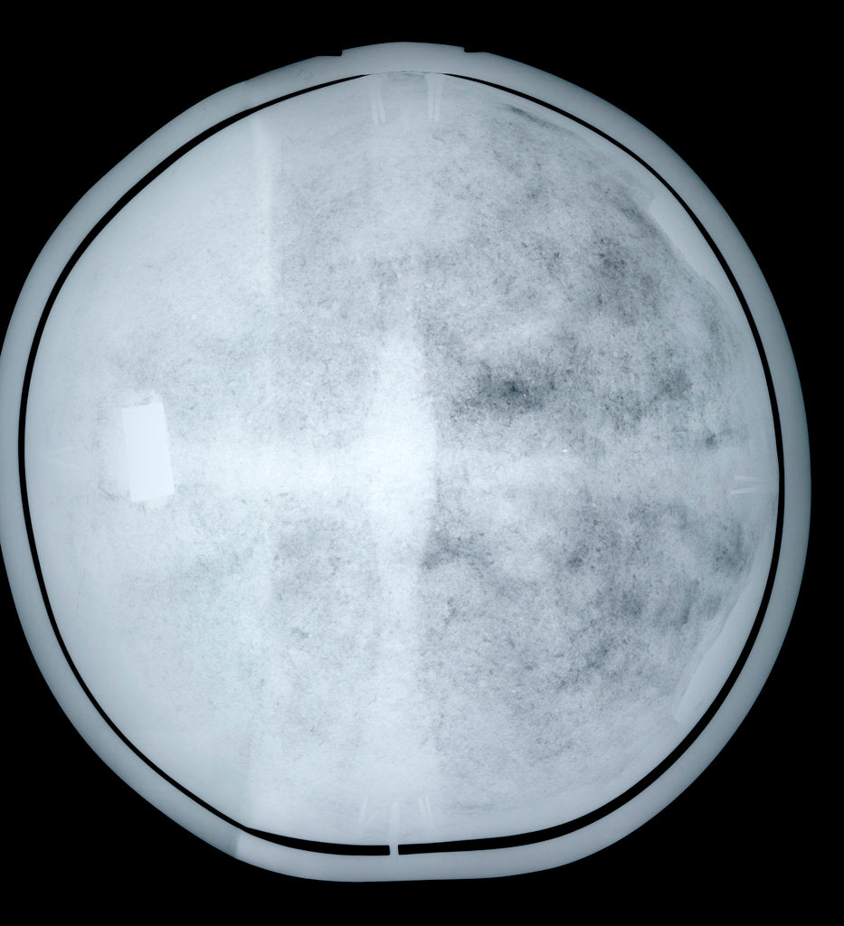 Detail of Globe x-ray by Jacob Aertsz Colom