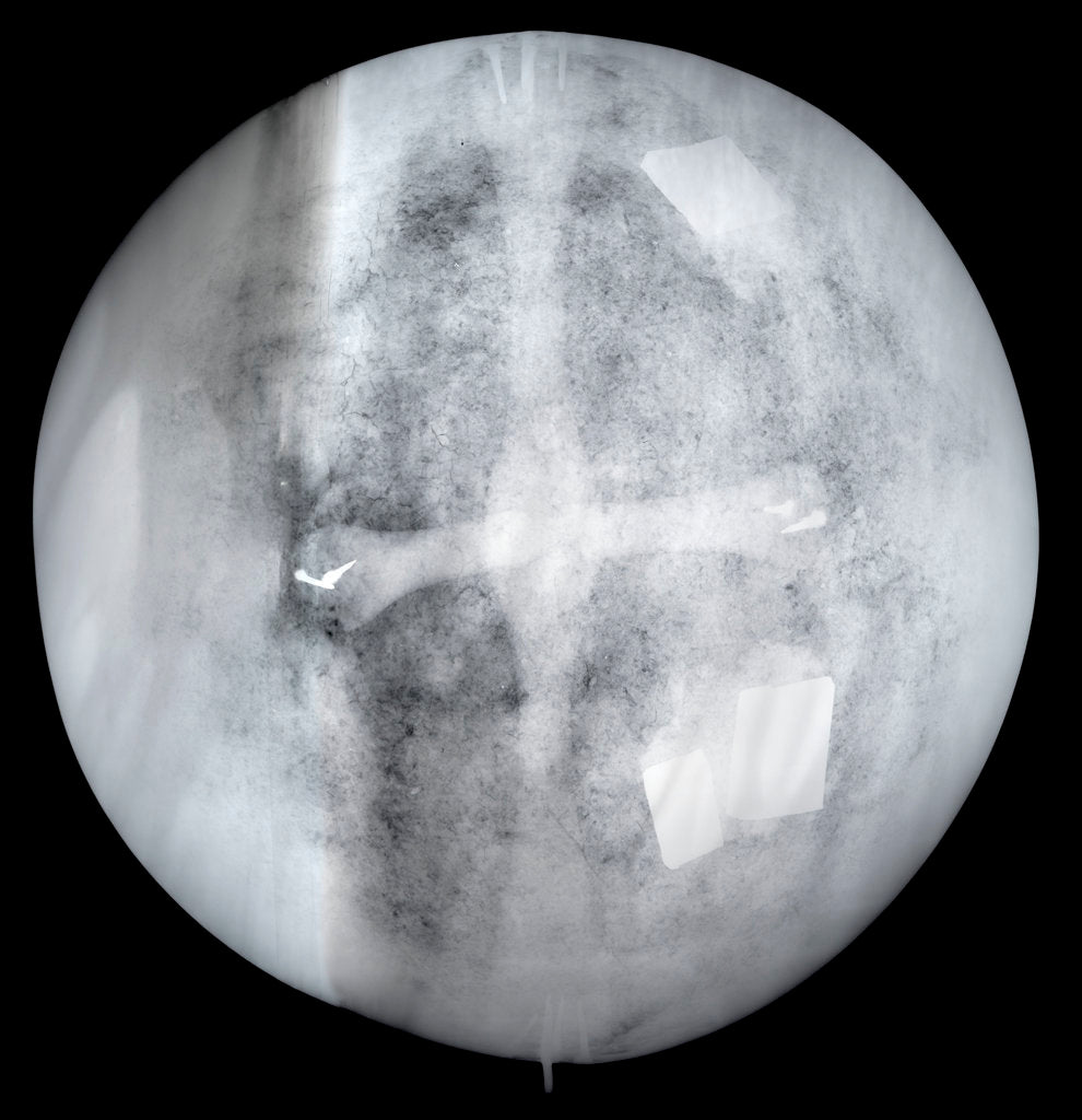 Detail of Globe x-ray by Jacob Aertsz Colom