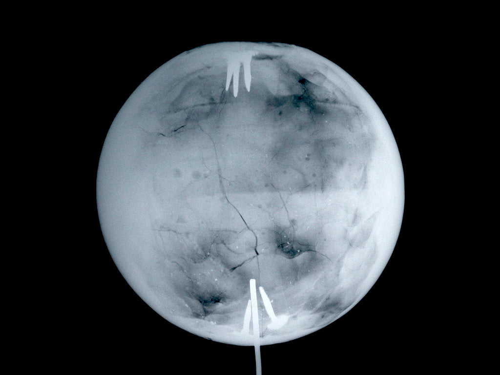Detail of Globe x-ray by Herman Moll