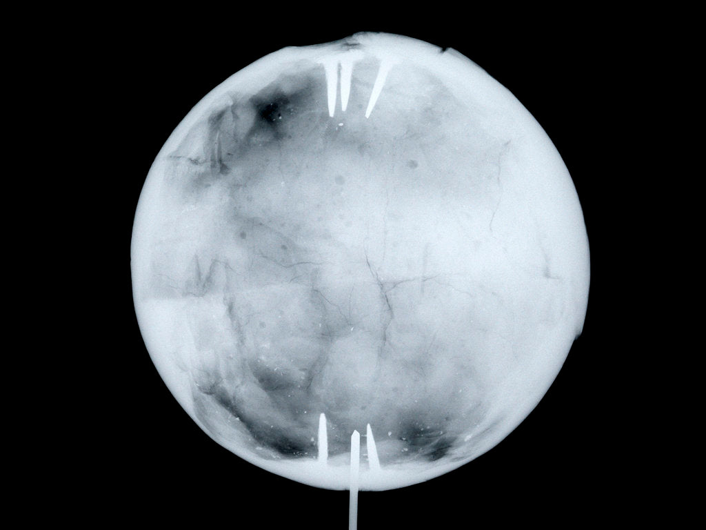 Detail of Globe x-ray by Herman Moll