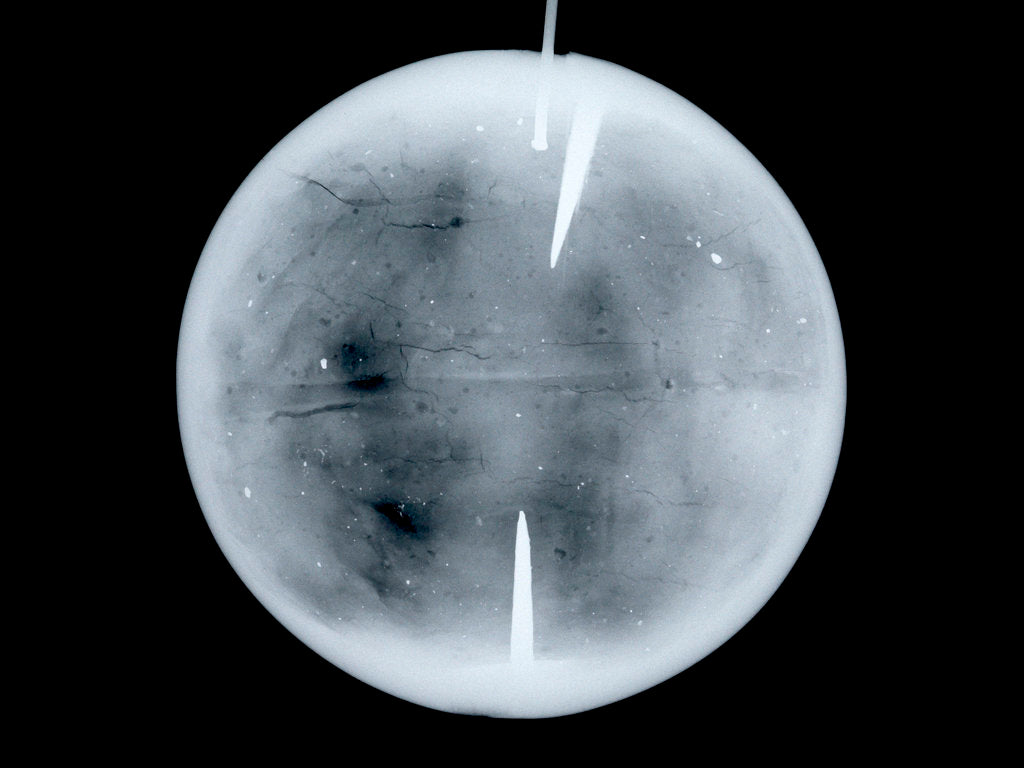 Detail of Globe x-ray by Dudley Adams