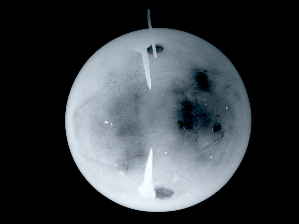Detail of Globe x-ray by Dudley Adams
