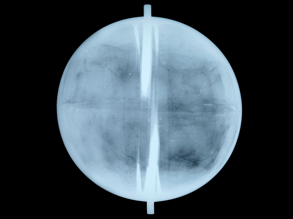 Detail of Globe x-ray by Thomas Patrick