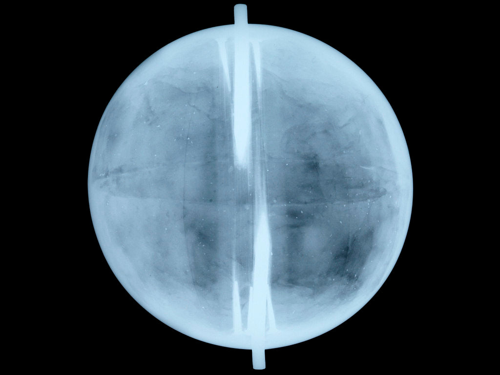 Detail of Globe x-ray by Thomas Patrick