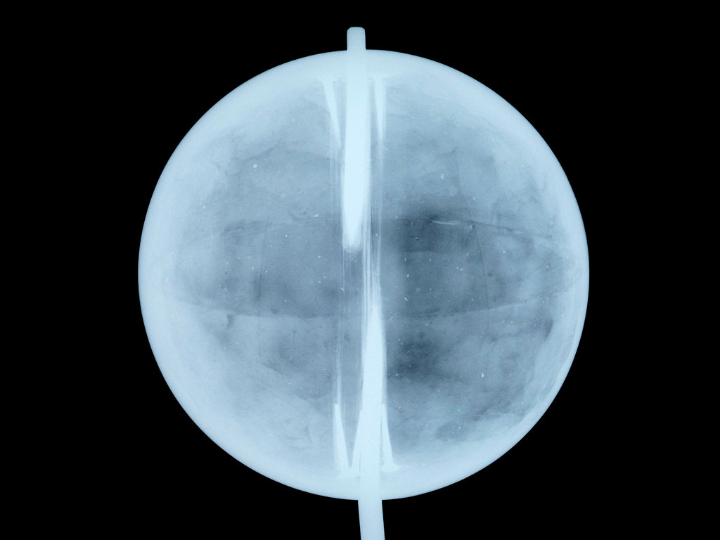 Detail of Globe x-ray by Thomas Patrick