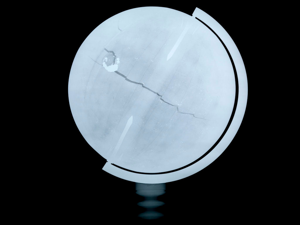 Detail of Globe x-ray by Newton & Co.