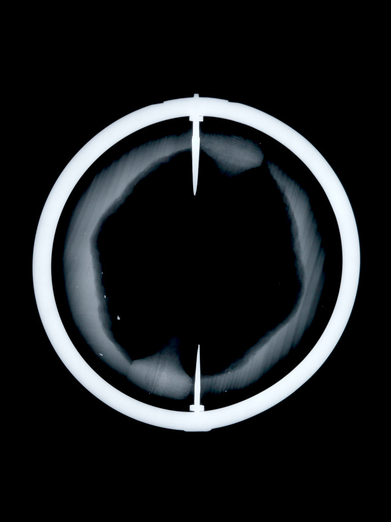 Detail of Globe x-ray by Joannes Oterschaden