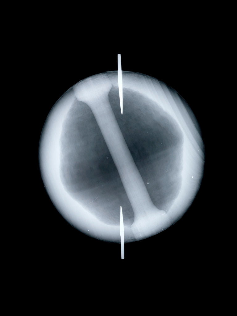Detail of Globe x-ray by Joannes Oterschaden